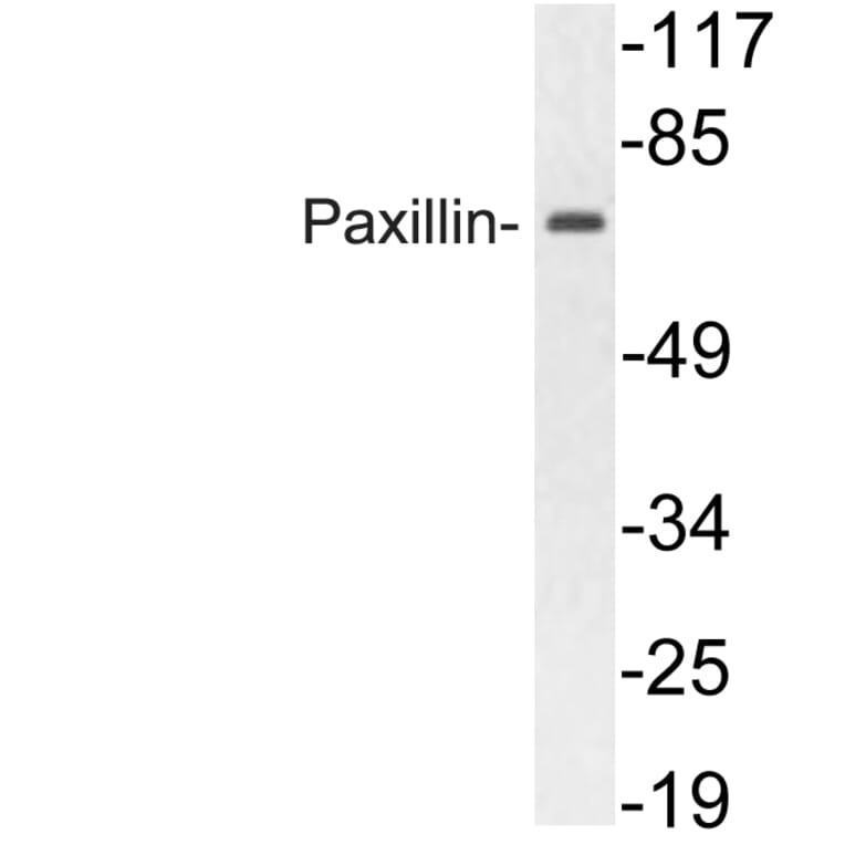 Western Blot - Anti-Paxillin Antibody (R12-2296) - Antibodies.com