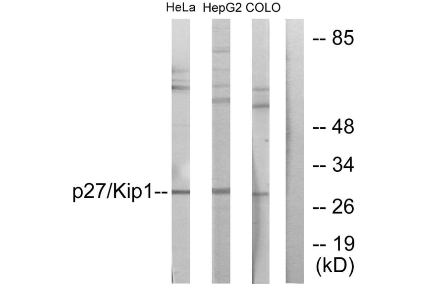 Western Blot - Anti-p27 Kip1 Antibody (B0965) - Antibodies.com