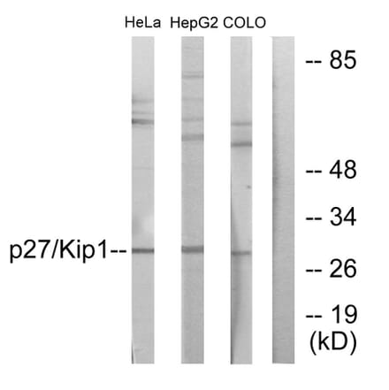 Western Blot - Anti-p27 Kip1 Antibody (B0965) - Antibodies.com