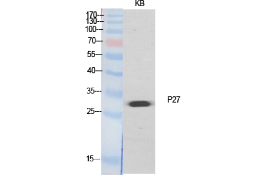 Western Blot - Anti-p27 Kip1 Antibody (B0965) - Antibodies.com