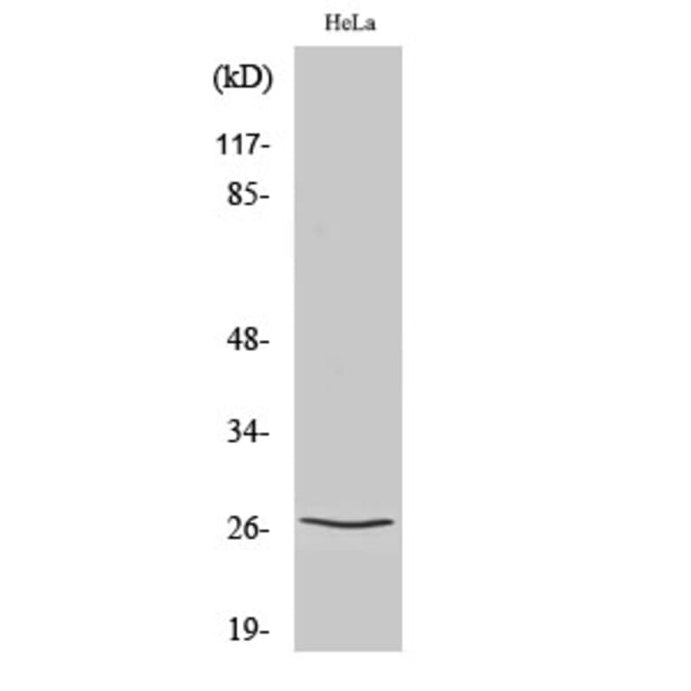 Western Blot - Anti-p27 Kip1 Antibody (B0965) - Antibodies.com