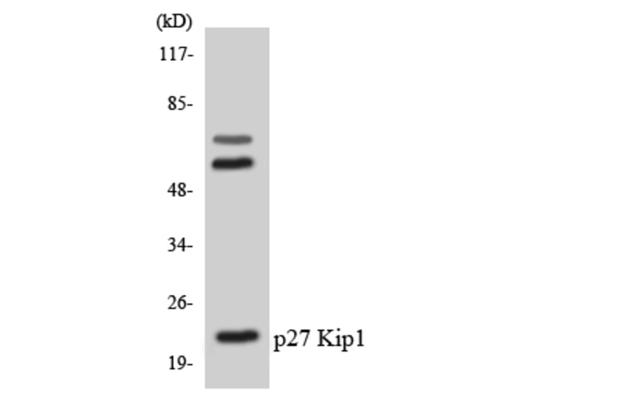 Western Blot - Anti-p27 Kip1 Antibody (R12-3279) - Antibodies.com