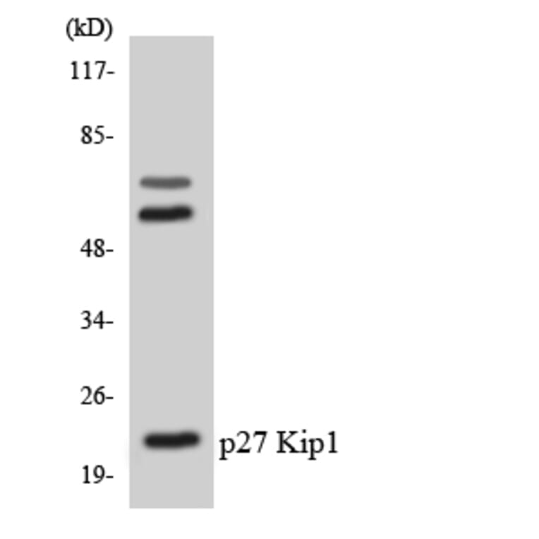 Western Blot - Anti-p27 Kip1 Antibody (R12-3279) - Antibodies.com
