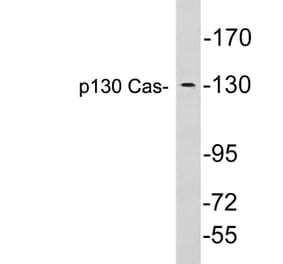 Western Blot - Anti-p130 Cas Antibody (R12-2284) - Antibodies.com