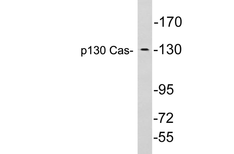 Western Blot - Anti-p130 Cas Antibody (R12-2284) - Antibodies.com