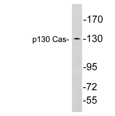Western Blot - Anti-p130 Cas Antibody (R12-2284) - Antibodies.com