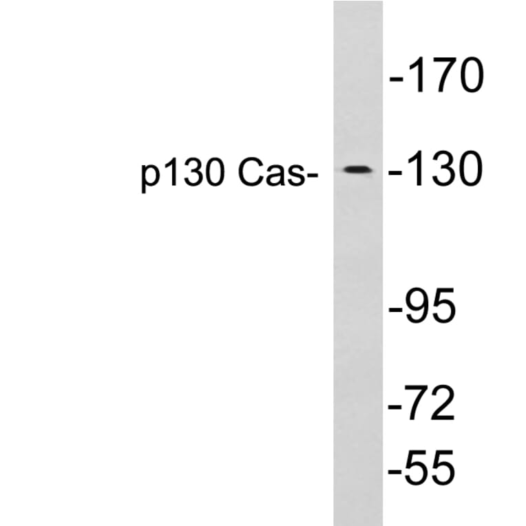 Western Blot - Anti-p130 Cas Antibody (R12-2284) - Antibodies.com