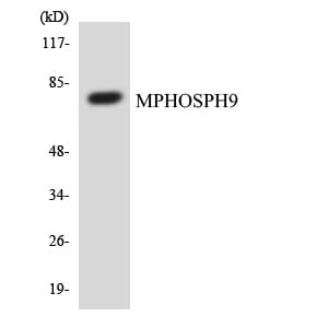 Western blot analysis of the lysates from COLO205 cells using Anti-MPHOSPH9 Antibody.