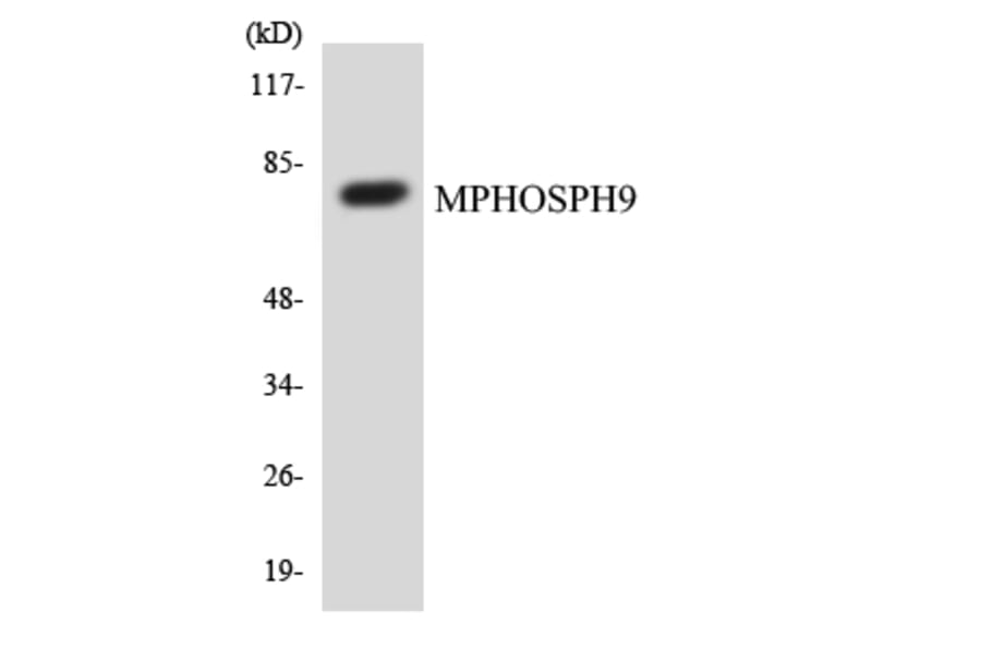 Western Blot - Anti-MPHOSPH9 Antibody (R12-3028) - Antibodies.com