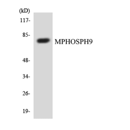 Western Blot - Anti-MPHOSPH9 Antibody (R12-3028) - Antibodies.com