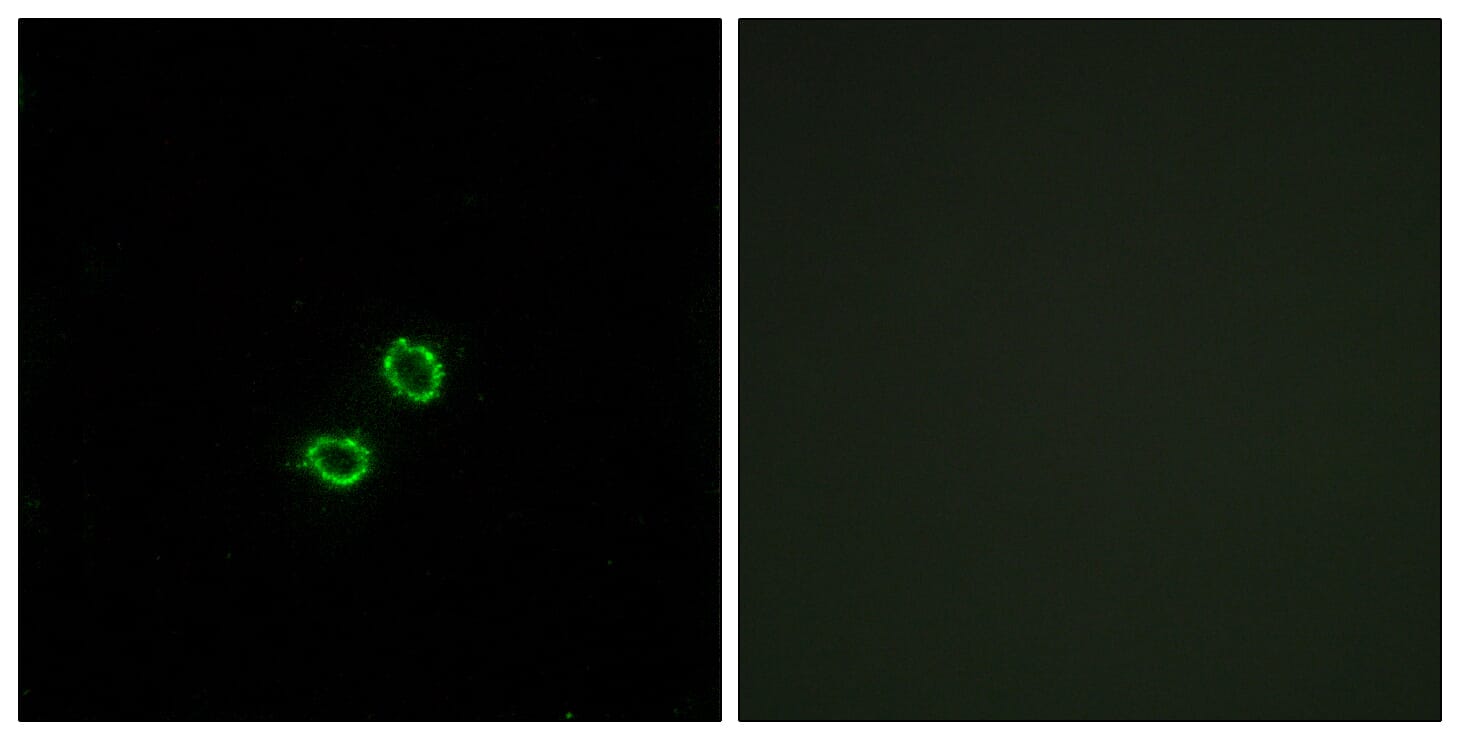 Immunofluorescence analysis of A549 cells using Anti-KIR2DL5B Antibody. The right hand panel represents a negative control, where the antibody was pre-incubated with the immunising peptide.