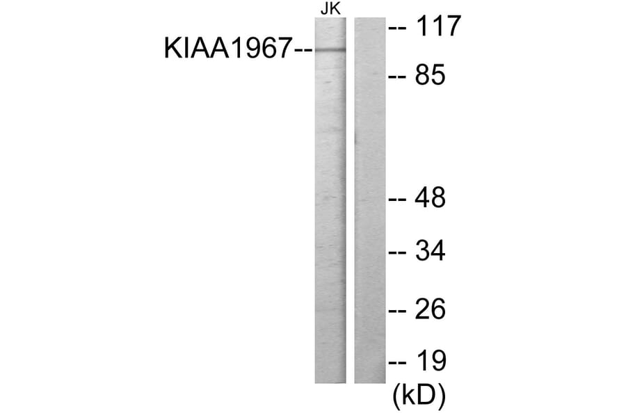 Western Blot - Anti-KIAA1967 Antibody (C11338) - Antibodies.com