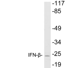 Western Blot - Anti-IFN-beta Antibody (R12-2192) - Antibodies.com