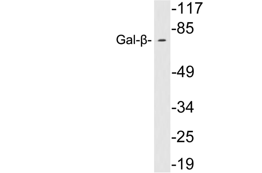 Western Blot - Anti-Gal-beta Antibody (R12-2153) - Antibodies.com