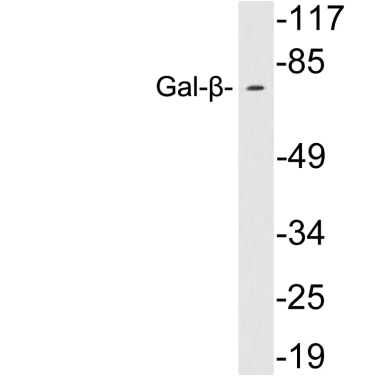 Western Blot - Anti-Gal-beta Antibody (R12-2153) - Antibodies.com