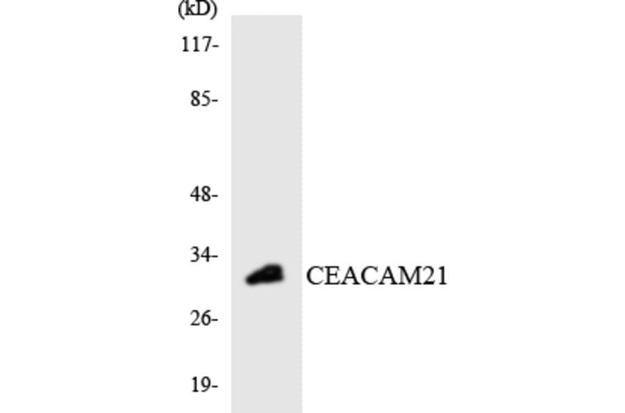 Western Blot - Anti-CEACAM21 Antibody (R12-2610) - Antibodies.com