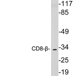 Western Blot - Anti-CD8-beta Antibody (R12-2085) - Antibodies.com