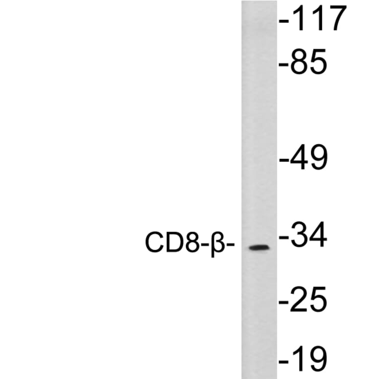 Western Blot - Anti-CD8-beta Antibody (R12-2085) - Antibodies.com