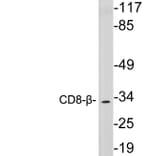 Western Blot - Anti-CD8-beta Antibody (R12-2085) - Antibodies.com