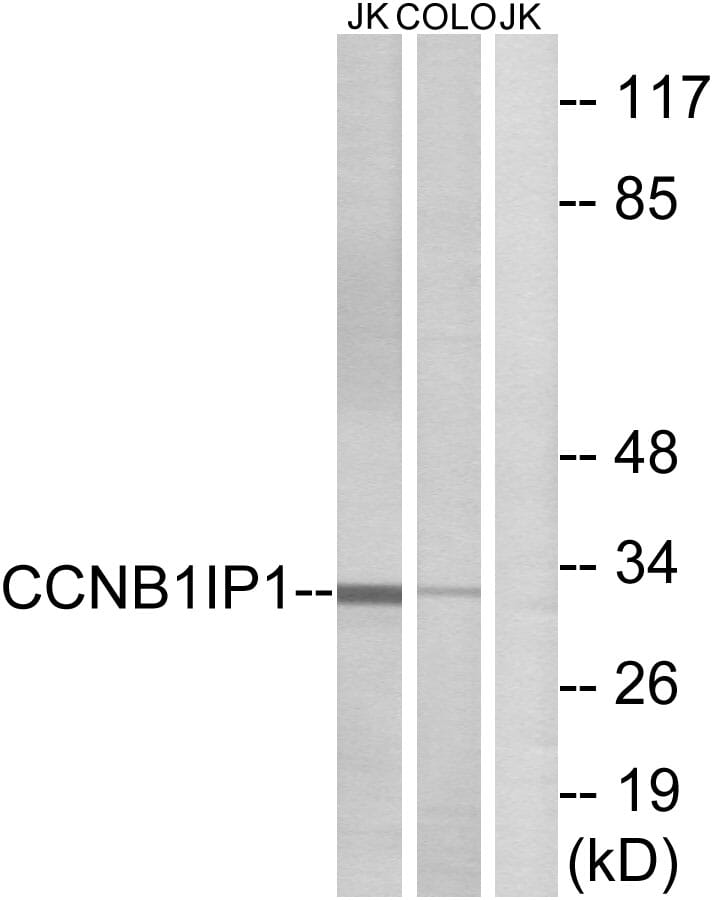 Western blot analysis of lysates from Jurkat and COLO cells using Anti-CCNB1IP1 Antibody. The right hand lane represents a negative control, where the antibody is blocked by the immunising peptide.