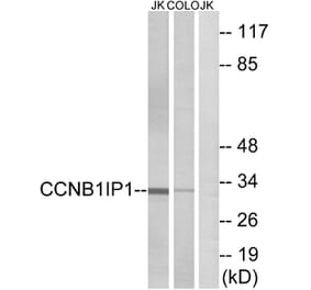 Western Blot - Anti-CCNB1IP1 Antibody (C15533) - Antibodies.com