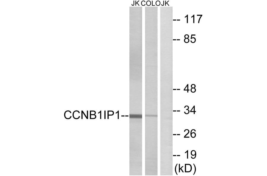 Western Blot - Anti-CCNB1IP1 Antibody (C15533) - Antibodies.com