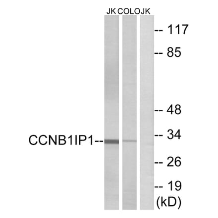 Western Blot - Anti-CCNB1IP1 Antibody (C15533) - Antibodies.com