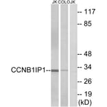 Western Blot - Anti-CCNB1IP1 Antibody (C15533) - Antibodies.com