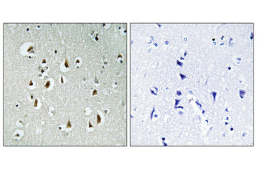Immunohistochemistry - Anti-CCNB1IP1 Antibody (C15533) - Antibodies.com