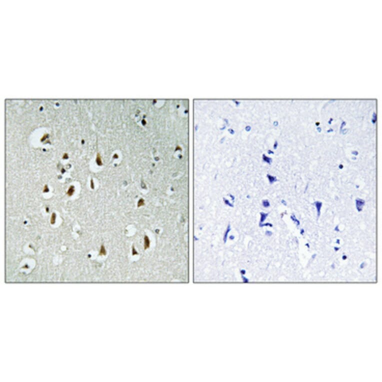 Immunohistochemistry - Anti-CCNB1IP1 Antibody (C15533) - Antibodies.com