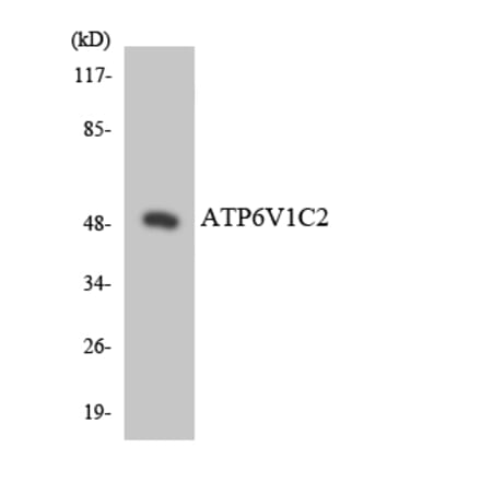 Western Blot - Anti-ATP6V1C2 Antibody (R12-2521) - Antibodies.com