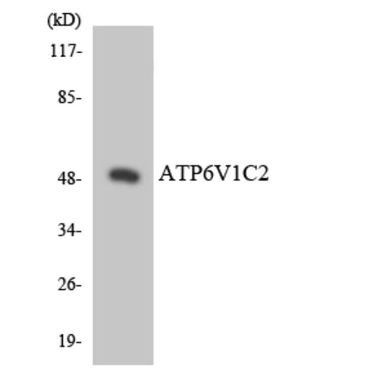 Western Blot - Anti-ATP6V1C2 Antibody (R12-2521) - Antibodies.com