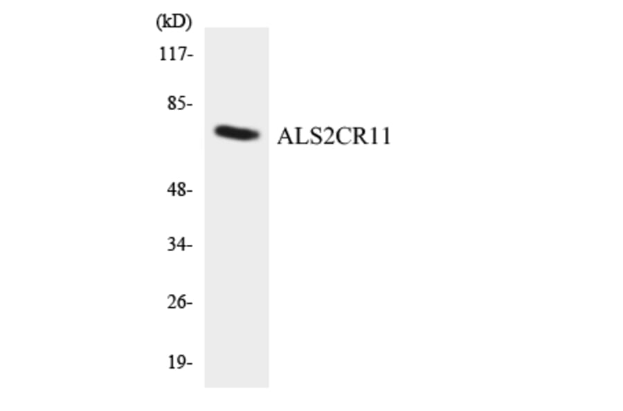 Western Blot - Anti-ALS2CR11 Antibody (R12-2480) - Antibodies.com