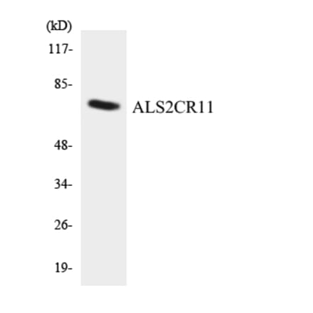 Western Blot - Anti-ALS2CR11 Antibody (R12-2480) - Antibodies.com