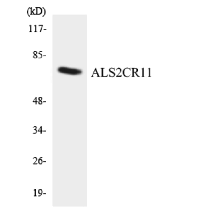 Western Blot - Anti-ALS2CR11 Antibody (R12-2480) - Antibodies.com