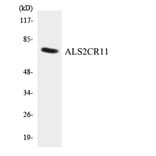Western Blot - Anti-ALS2CR11 Antibody (R12-2480) - Antibodies.com