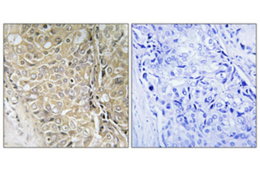 Immunohistochemistry - Anti-TPD52L3 Antibody (C11501) - Antibodies.com