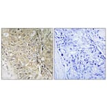 Immunohistochemistry - Anti-TPD52L3 Antibody (C11501) - Antibodies.com