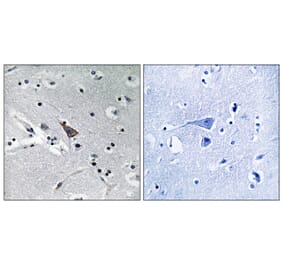 Immunohistochemistry - Anti-SLC6A16 Antibody (C17576) - Antibodies.com