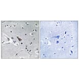 Immunohistochemistry - Anti-SLC6A16 Antibody (C17576) - Antibodies.com