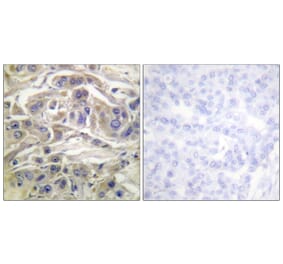 Immunohistochemistry - Anti-RapGEF1 Antibody (B1120) - Antibodies.com