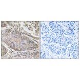 Immunohistochemistry - Anti-PLA2G4E Antibody (C15307) - Antibodies.com
