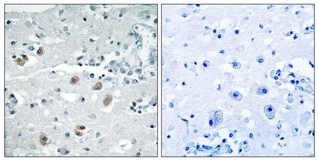 Immunohistochemical analysis of paraffin-embedded human brain using Anti-PLA2G4D Antibody. The right hand panel represents a negative control, where the antibody was pre-incubated with the immunising peptide.