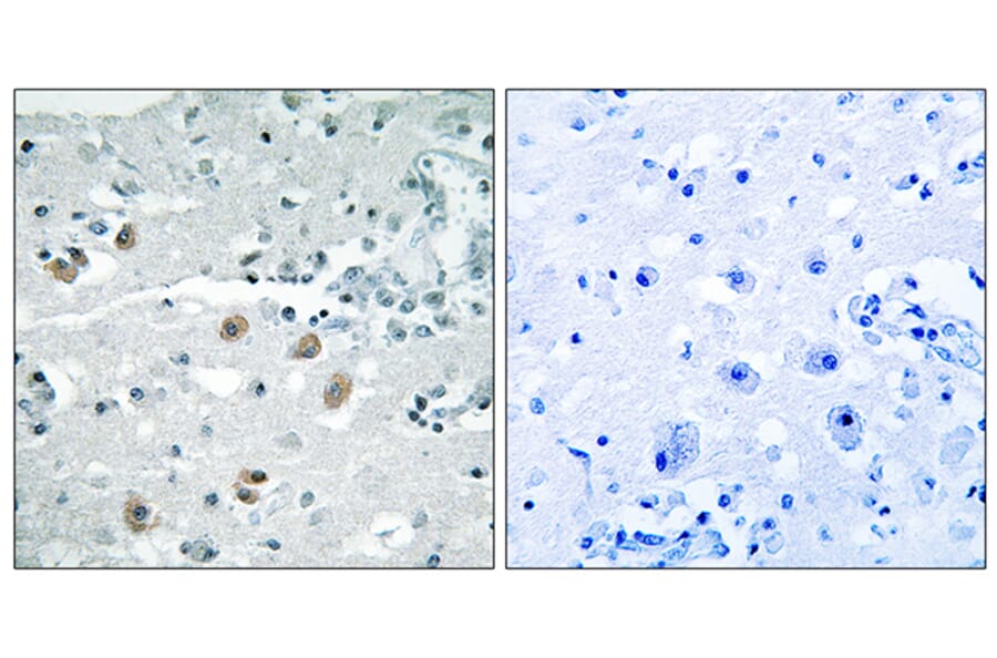 Immunohistochemistry - Anti-PLA2G4D Antibody (C15306) - Antibodies.com