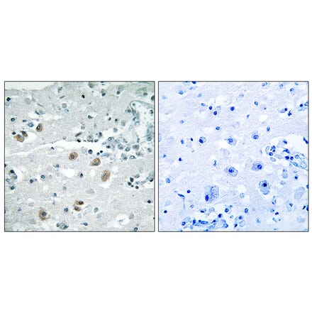 Immunohistochemistry - Anti-PLA2G4D Antibody (C15306) - Antibodies.com