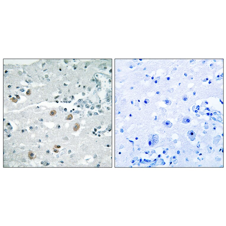 Immunohistochemistry - Anti-PLA2G4D Antibody (C15306) - Antibodies.com