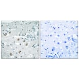 Immunohistochemistry - Anti-PLA2G4D Antibody (C15306) - Antibodies.com