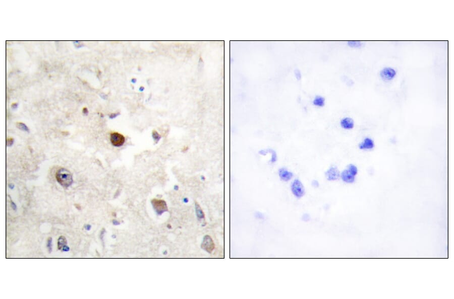 Immunohistochemistry - Anti-p57KIP2 Antibody (C10659) - Antibodies.com