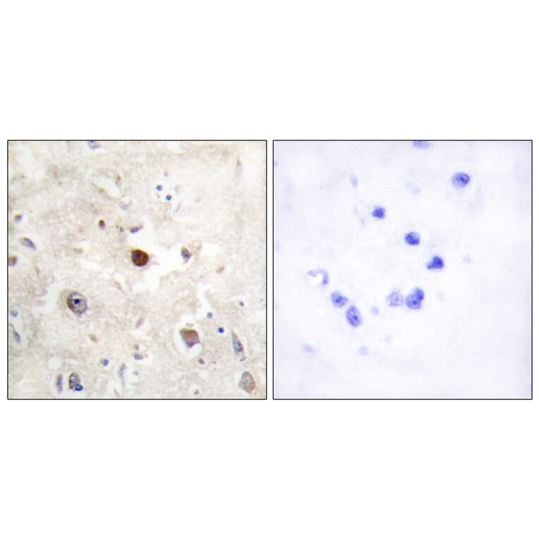 Immunohistochemistry - Anti-p57KIP2 Antibody (C10659) - Antibodies.com