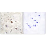 Immunohistochemistry - Anti-p57KIP2 Antibody (C10659) - Antibodies.com